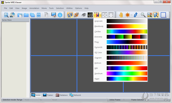 Sante CT Viewer