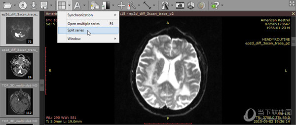 RadiAnt DICOM Viewer