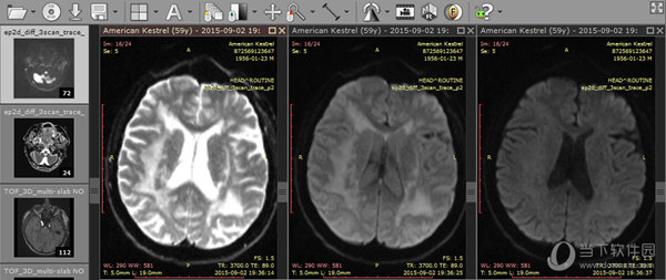 RadiAnt DICOM Viewer