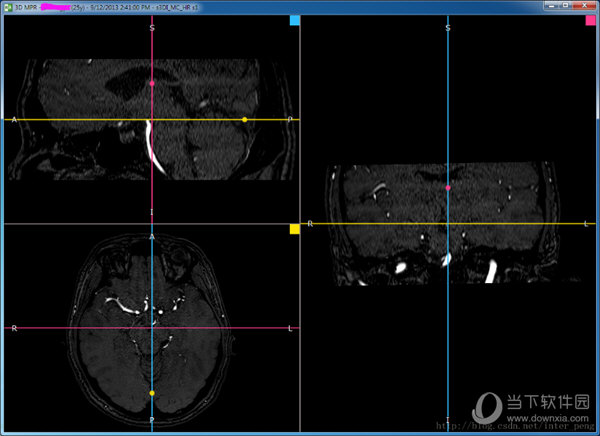 RadiAnt DICOM Viewer