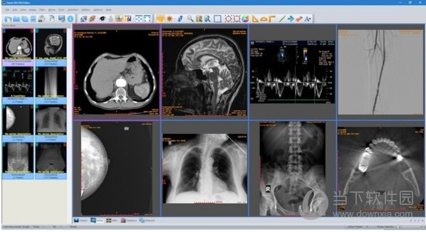 Sante DICOM Editor