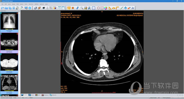 radiant dicom