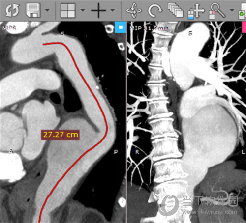 radiant dicom