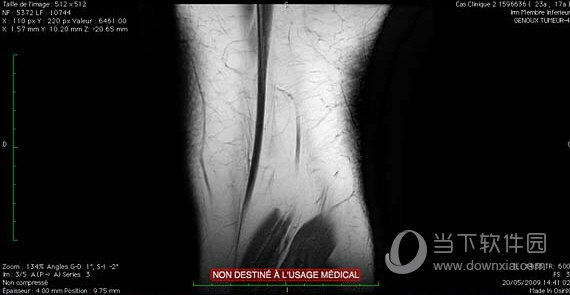 DICOM Image Viewer